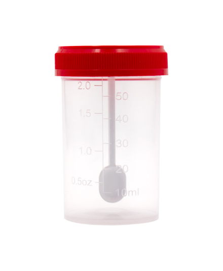 علبة فحص براز - حمراء - معقمة